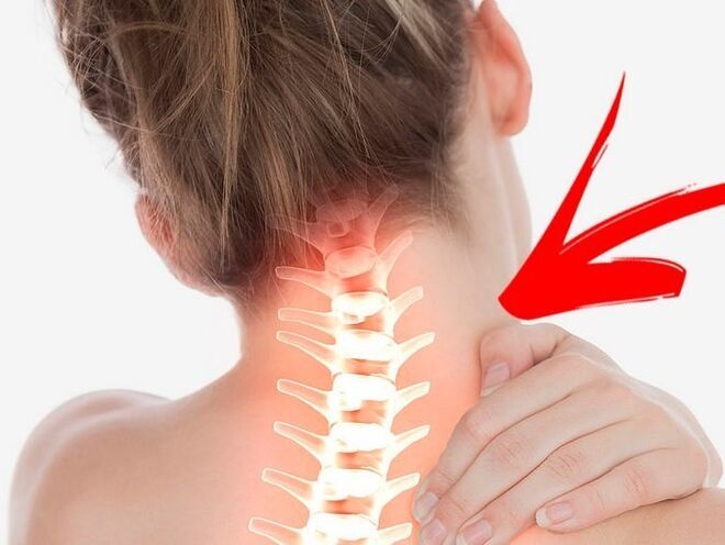 گریوا اوسٹیوچنڈروسس کے ساتھ اعصابی جڑوں کی کمپریشن