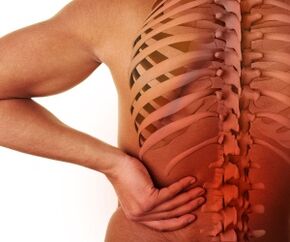 کمر میں درد lumbar osteochondrosis کے ساتھ
