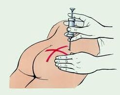 osteochondrosis کے علاج کے لئے انجکشن